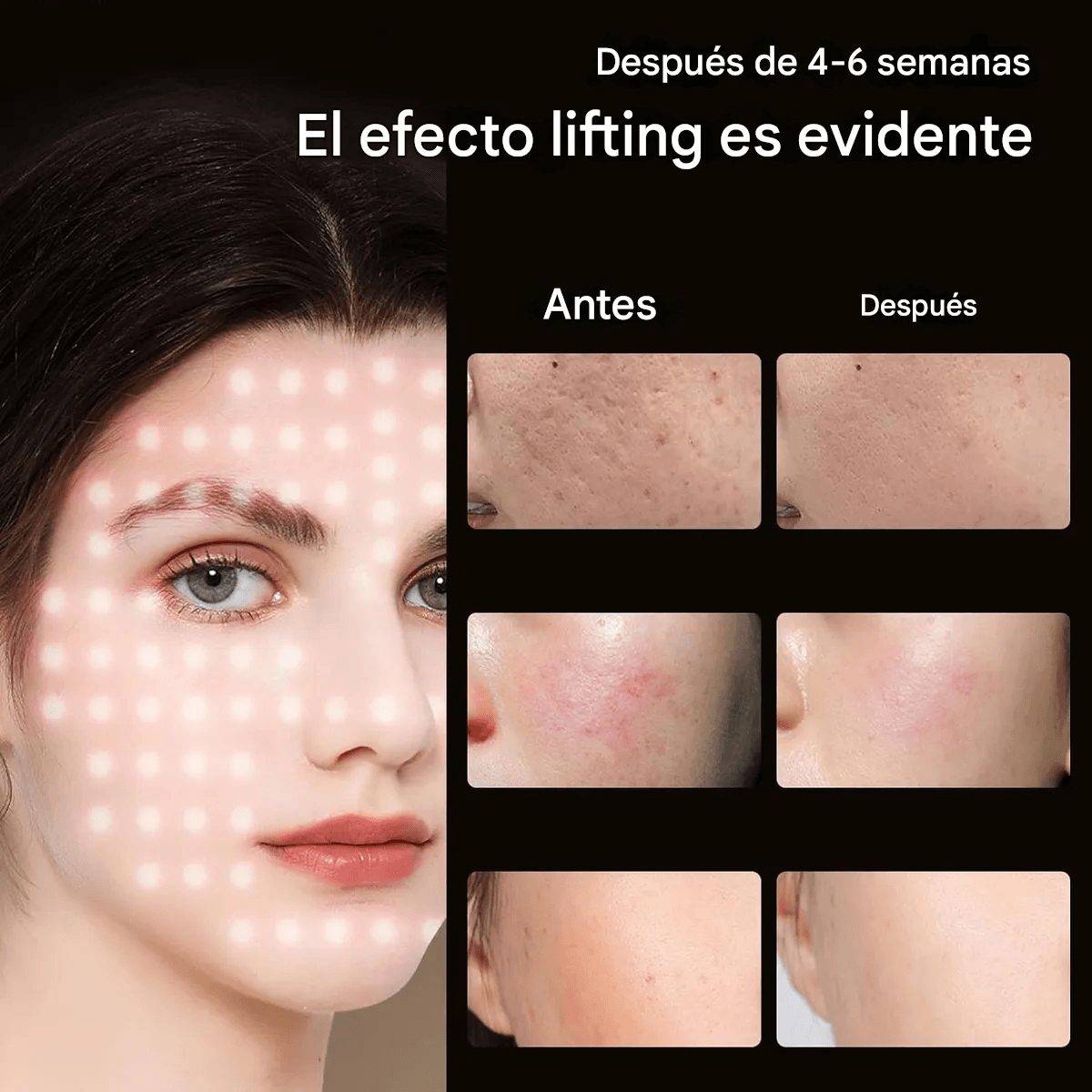 Mascara De Luz Infrarroja Portatil Ayuda A Cuidar Tu Piel - Imagen 8