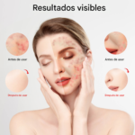Mascara De Luz Infrarroja Portatil Ayuda A Cuidar Tu Piel – Biogate Argentina